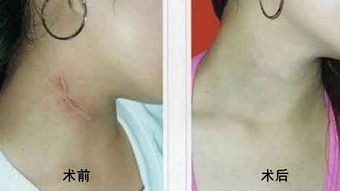上海中西醫(yī)結(jié)合醫(yī)院整形美容科靠譜嗎？聽說口碑不錯！