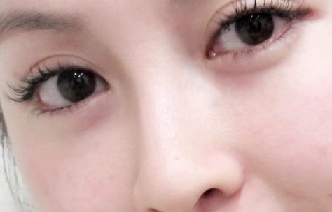 在烏魯木齊有哪些值得推薦的開眼角好醫(yī)院？