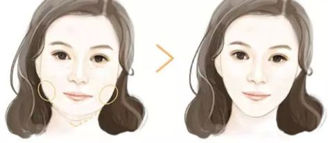 上海哪家下頜骨醫(yī)院好？解析上海下頜骨疾病常見病例及專業(yè)治療！