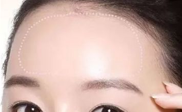 蘇州哪家黃褐斑醫(yī)院好？專業(yè)醫(yī)生推薦，讓你告別黃褐斑困擾！