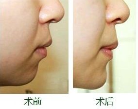 南寧整形豐胸醫(yī)院排名及評價互動：哪家醫(yī)院效果更好？