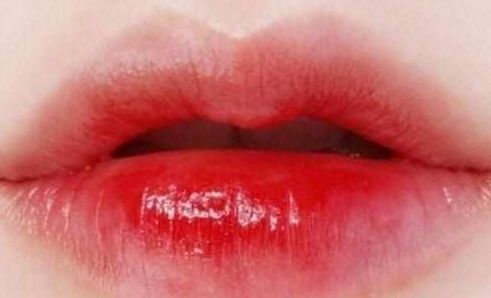 南寧祛疤整形哪家醫(yī)院最專業(yè)最受好評？