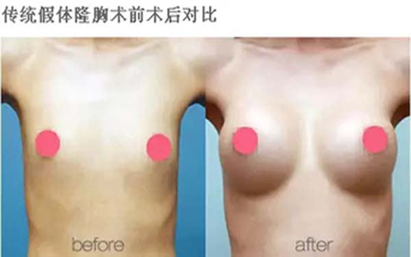 溫州雍禾醫(yī)院信譽(yù)如何？求推薦占家佳醫(yī)生植發(fā)效果如何？或溫州雍禾醫(yī)院口碑怎么樣？哪位醫(yī)生適合占家佳植發(fā)