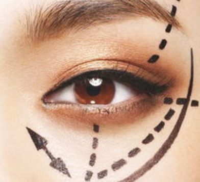 蘭州眼睛美容醫(yī)院哪家好？揭秘蘭州市最受歡迎的眼睛美容醫(yī)院排行榜！