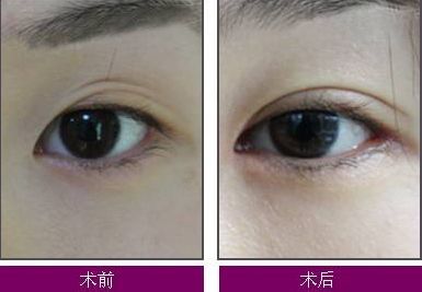 煙臺(tái)整疤痕哪家醫(yī)院好？了解煙臺(tái)整疤痕醫(yī)院的綜合評(píng)價(jià)和治療效果