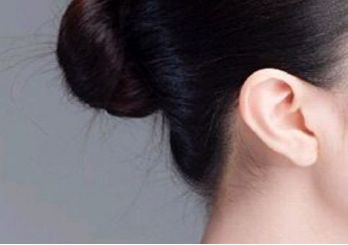 鄭州趙麗做雙眼皮修復效果如何？整形醫(yī)生背景和坐診情況請看！