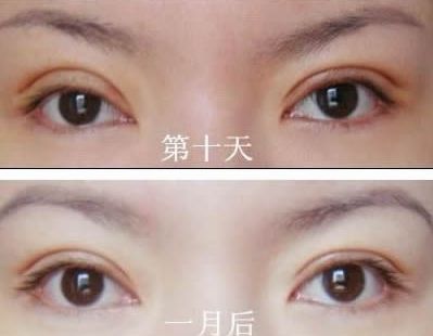 長(zhǎng)春哪家醫(yī)院治痘痘好？了解長(zhǎng)春市治療青春痘的?？漆t(yī)院及價(jià)格