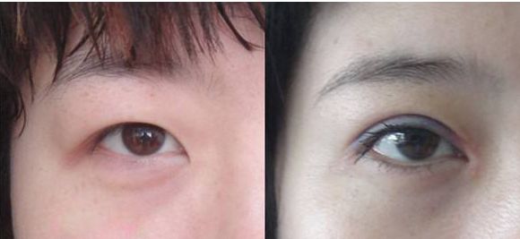 北京豐胸整形醫(yī)院哪家好？綜合評價和患者口碑推薦