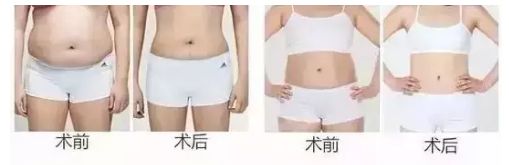 信陽去整形哪家醫(yī)院好？名副其實信陽市最佳整形醫(yī)院TOP推薦