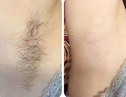 上海整形醫(yī)院哪家的好？最權(quán)威的排名榜單來幫你挑選！