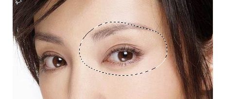 成都米蘭柏羽盧尚兵雙眼皮是否有效？美杜莎美眼術技術真如傳說中那么神奇？
