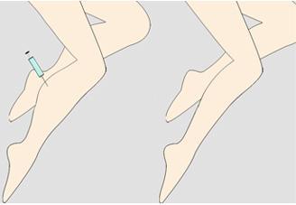 上海李昕醫(yī)生隆鼻技術(shù)實(shí)力有多強(qiáng)？揭秘國內(nèi)必備的一位鼻部整形專家