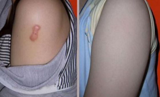 上海雙眼皮切開手術(shù)，哪家醫(yī)院技術(shù)好且安全？
