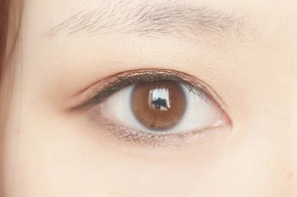 深圳北大醫(yī)院自體脂肪填充的效果如何？何君君醫(yī)生的資料和擅長(zhǎng)特點(diǎn)分享！
