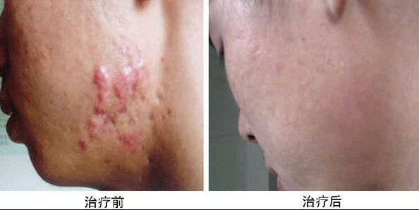 南京哪家醫(yī)院做兔唇手術(shù)效果好又安全？