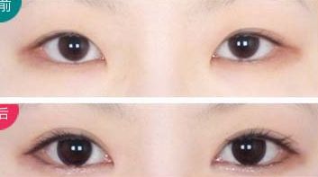 西安治療瘢痕哪家醫(yī)院好評(píng)不斷！