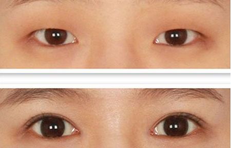 北京整容科好的醫(yī)院有哪些？中關(guān)村整形醫(yī)院綜合實(shí)力領(lǐng)先！