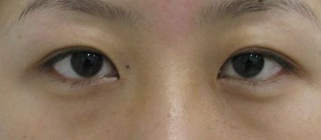 南寧哪家美容整形醫(yī)院口碑好又實惠？