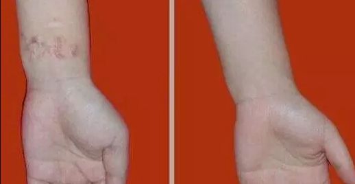 杭州哪家醫(yī)院看喉嚨好？排名最好的專(zhuān)業(yè)醫(yī)院推薦