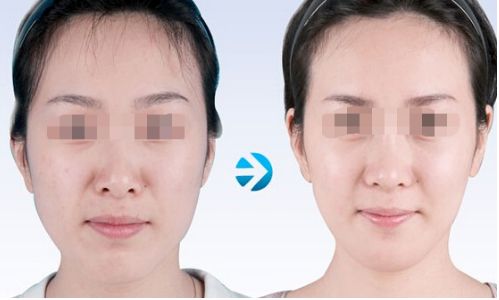 云南雙眼皮手術有哪些優(yōu)質醫(yī)院值得推薦？