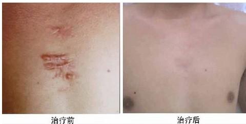 2023長(zhǎng)沙微整形祛疤祛痘排行榜十強(qiáng)專家(張嬌嬌、劉俐婧、陳詠玲詳版簡(jiǎn)介展示!)