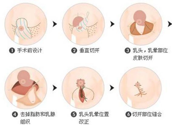 保定的整形醫(yī)院哪家好？全面解析保定整形醫(yī)院排名、口碑、專業(yè)團隊等