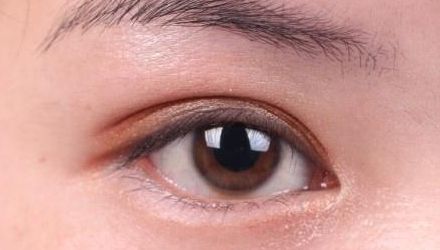 蘇州雙眼皮修復醫(yī)院排名及口碑，哪家醫(yī)院修復效果最好？
