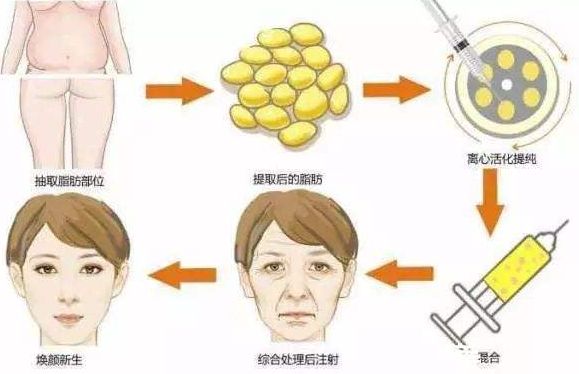 重慶整形磨骨哪家醫(yī)院好？整形醫(yī)院排行榜解讀，選擇最適合您的醫(yī)院！