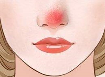 廣州最新開設(shè)的軍事美容整形醫(yī)院，王世虎是權(quán)威整形專家，手術(shù)價便宜