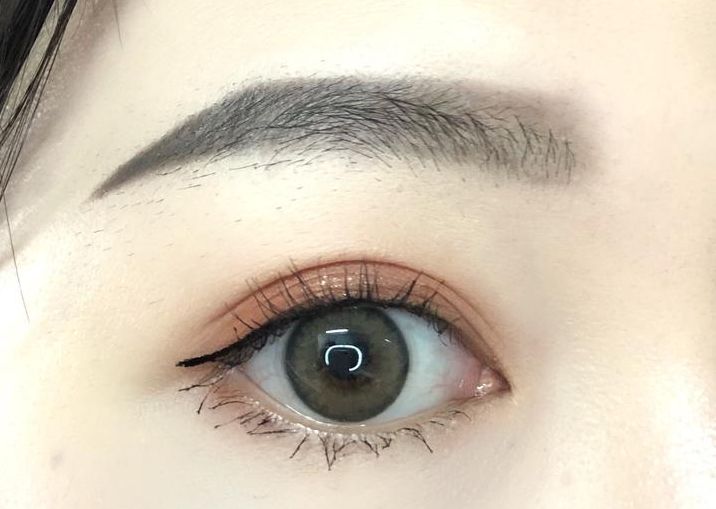 承德哪家整形醫(yī)院做雙眼皮效果好，選擇哪家醫(yī)院做雙眼皮效果最好