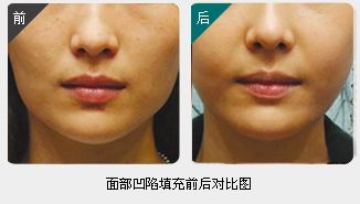 錦州整形美容醫(yī)院哪家靠譜？醫(yī)療技術(shù)如何？