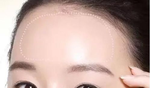 常州治療脫發(fā)哪家醫(yī)院靠譜？