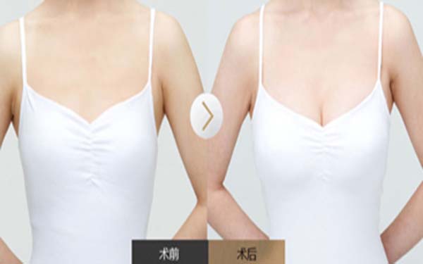 浙江同德醫(yī)院整形醫(yī)生名單、整形案例圖，為大家呈現(xiàn)