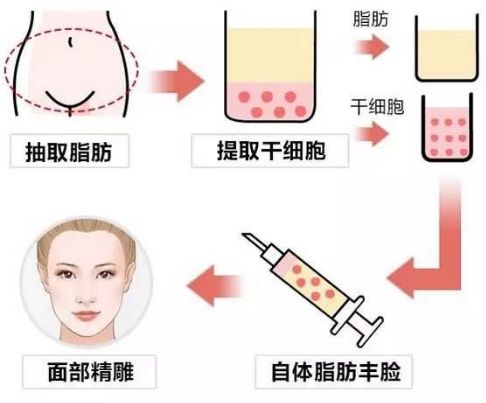 成都祛痘最好的醫(yī)院哪家好？探尋實力強(qiáng)勁、口碑爆棚的治療痘痘佳選