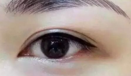 鄭州美麗時光醫(yī)療整形美容醫(yī)院費用如何？評論怎么樣？整容前必讀！