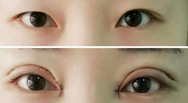 貴陽哪家醫(yī)院熱瑪吉效果好，值得推薦？
