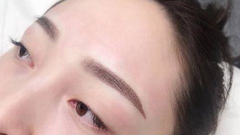 田國靜的眼袋修復(fù)價格如何？有推薦的醫(yī)生嗎？