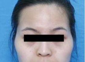 成都治療臉上痘痘哪家醫(yī)院好？專家推薦的成都治痘好醫(yī)院大揭秘！