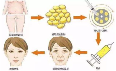 鄭州鼻整形哪家醫(yī)院好？一篇權威評測解答你的疑惑！