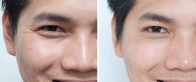 南京哪家整形醫(yī)院隆鼻效果最好？