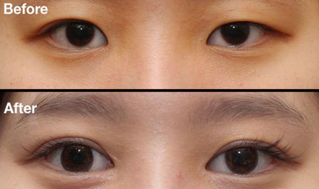 昆明刀疤修復哪家醫(yī)院好？挑選昆明專業(yè)刀疤修復醫(yī)院的技巧與要點