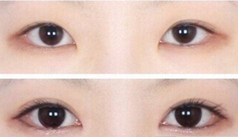 濟(jì)南哪家醫(yī)院的豐胸手術(shù)效果最好？