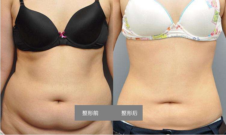 北京祛眼袋手術(shù)醫(yī)院排名前十強對比解析