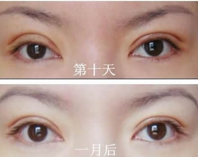 2023洛陽(yáng)額頭打除皺針在榜單前十位醫(yī)生(劉戰(zhàn)輝、黃浩浩、周先華手法嫻熟自然)