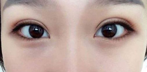 永州地區(qū)哪家正規(guī)整形醫(yī)院好？