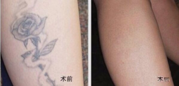 不二選擇！上海鼻修復(fù)專家徐永豐、劉仁輝搶占熱門名單成功！個人實力攀升不可阻擋！