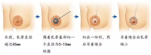 在哈爾濱做除皺哪家醫(yī)院好？選擇專業(yè)除皺醫(yī)生，享受高質(zhì)量護(hù)理服務(wù)
