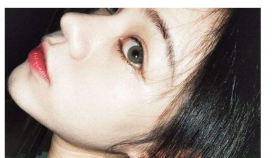 找一家靠譜的汕頭去除疤痕醫(yī)院？看這里！