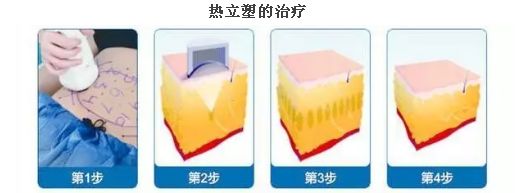 上海臉部祛斑哪家醫(yī)院好？揭秘上海市最受歡迎臉部祛斑醫(yī)院排行榜