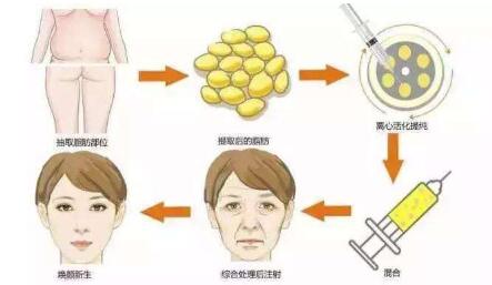 長沙鼻修復(fù)醫(yī)生推薦！多位專家實(shí)力PK，功力高出你的期待！最適合急需求的技術(shù)實(shí)力誰更強(qiáng)？